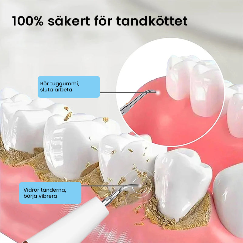Ultraljud tandrengörare