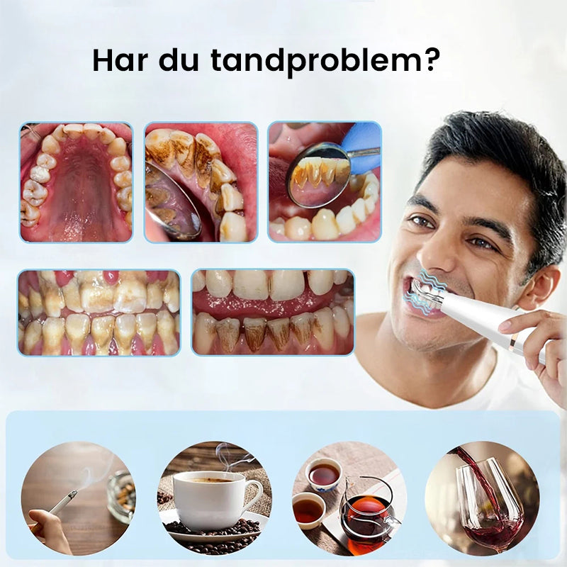 Ultraljud tandrengörare